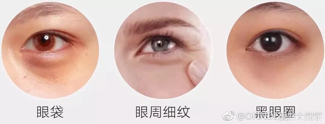 征服黑眼圈，手游达人的非电子冒险