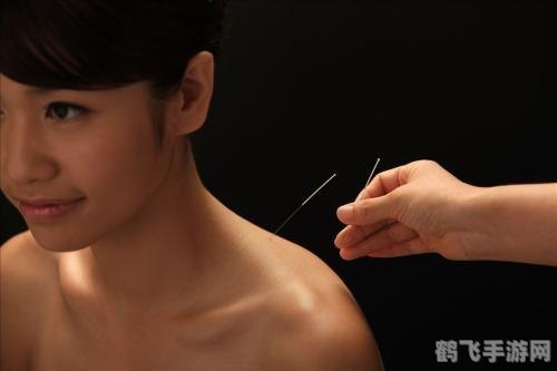 吴痛针灸什么梗,揭秘吴痛针灸网络热梗背后的故事与玩法解析