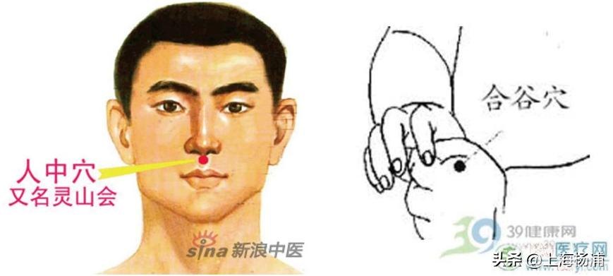 中暑急救误区揭秘,掐人中真的有用吗?手游玩家的健康攻略